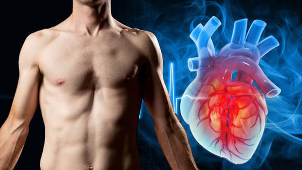 Understanding Pectus Excavatum: A Hidden Threat to Heart Health