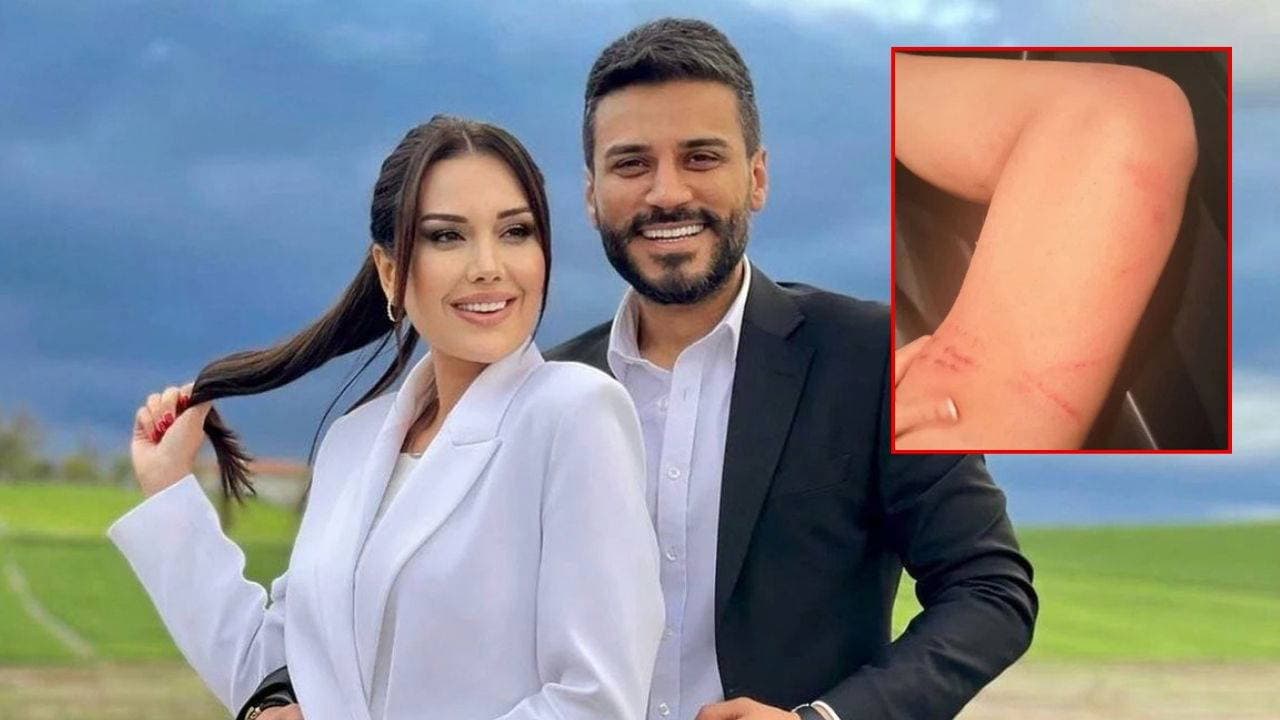 Dilan Polat Sparks Controversy by Sharing and Deleting Abuse Marks on Social Media