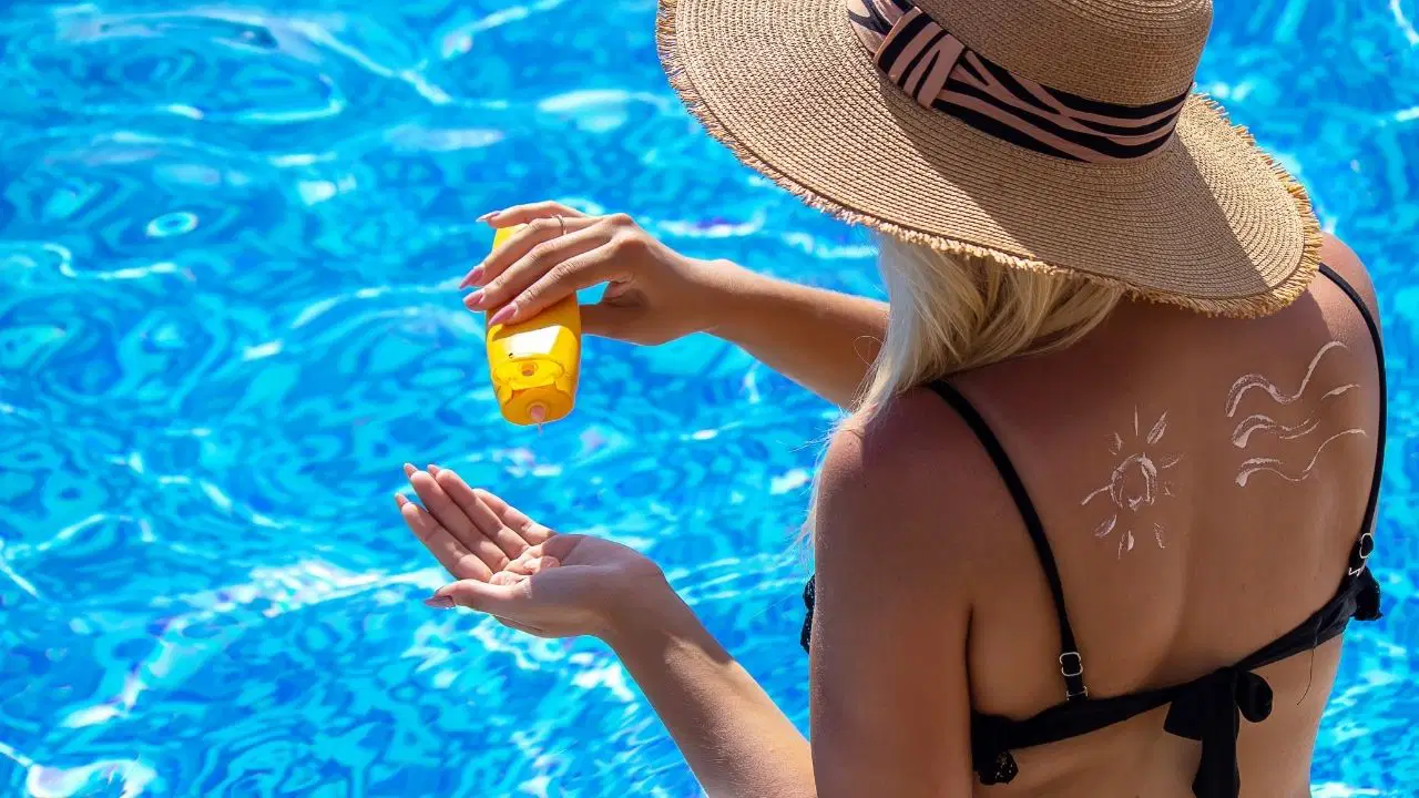 Don't Underestimate Sunburns: Risks Can Surface Years Later