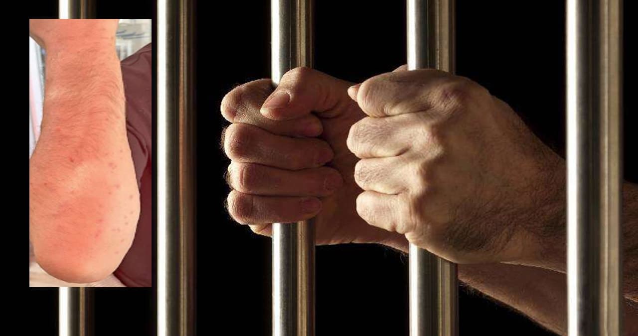 Bed Bug Infestations Cause Distress Among Inmates
