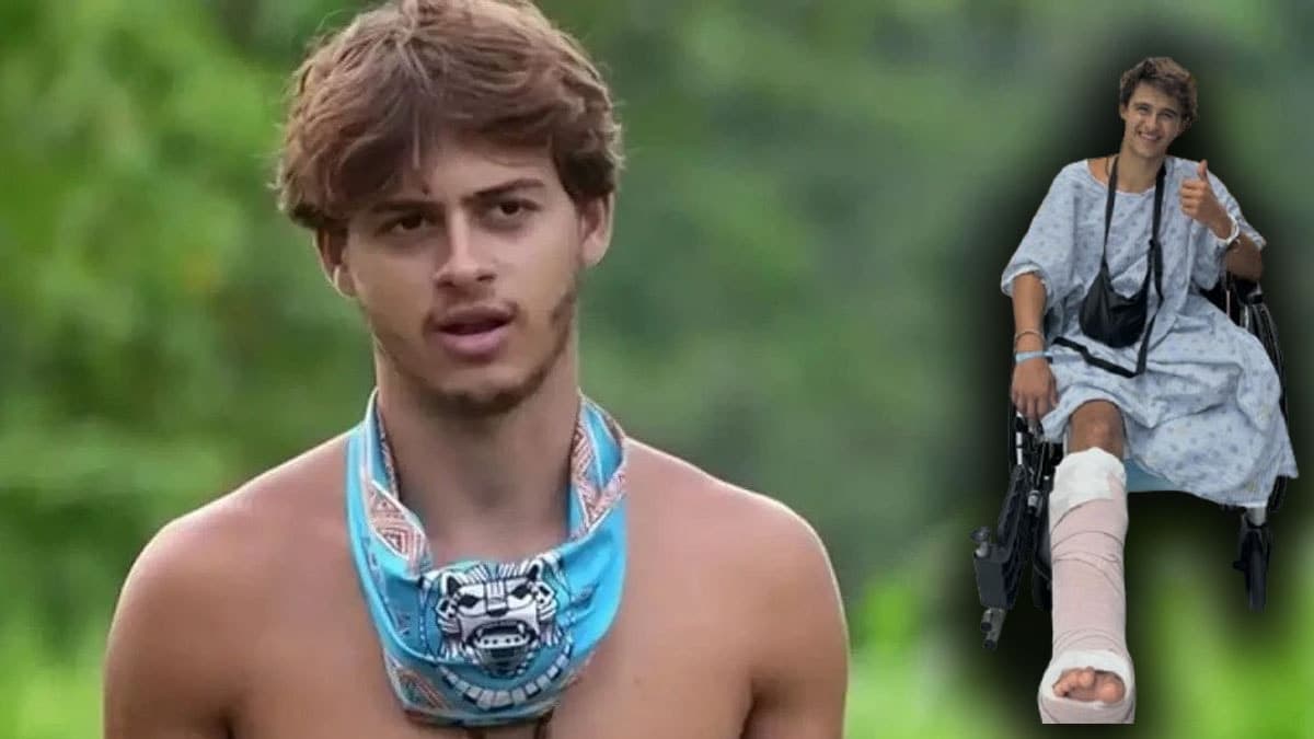 Survivor Contestant Files Million-Dollar Lawsuit After Amputation
